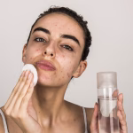 10 Langkah Membentuk Rutinitas Skincare untuk Kulit Berjerawat