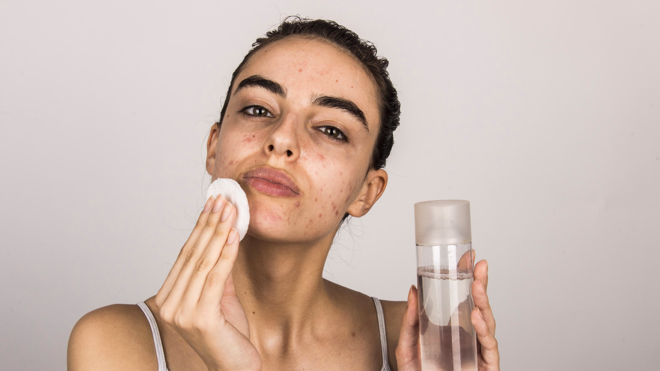10 Langkah Membentuk Rutinitas Skincare untuk Kulit Berjerawat